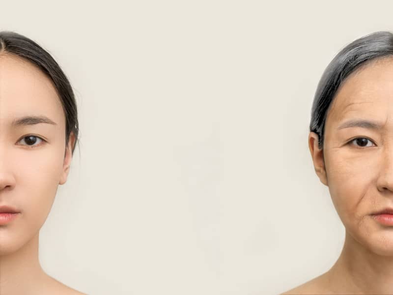 What Happens When You Lose Collagen